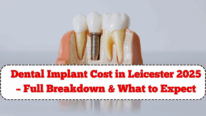 Dental Implant Cost in Leicester 2025 – Full Breakdown & What to Expect