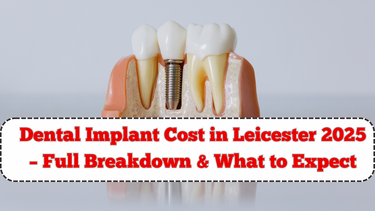 Dental Implant Cost in Leicester 2025 – Full Breakdown & What to Expect