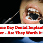 Same Day Dental Implants in Leicester – Are They Worth It in 2025?