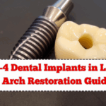 All-on-4 Dental Implants in Leicester – Full Arch Restoration Guide 2025