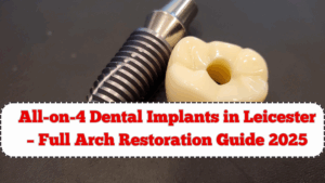 All-on-4 Dental Implants in Leicester – Full Arch Restoration Guide 2025