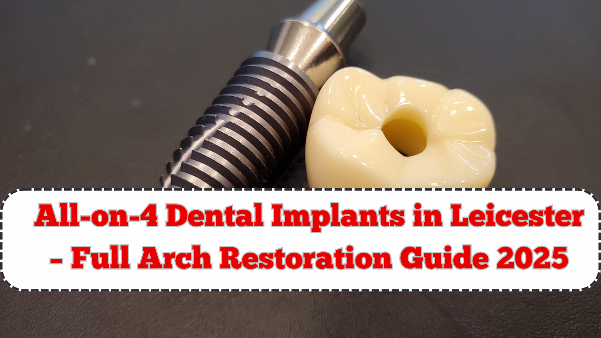 All-on-4 Dental Implants in Leicester – Full Arch Restoration Guide 2025