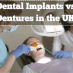 Dental Implants vs Dentures in the UK – Which Is the Better Long-Term Choice?