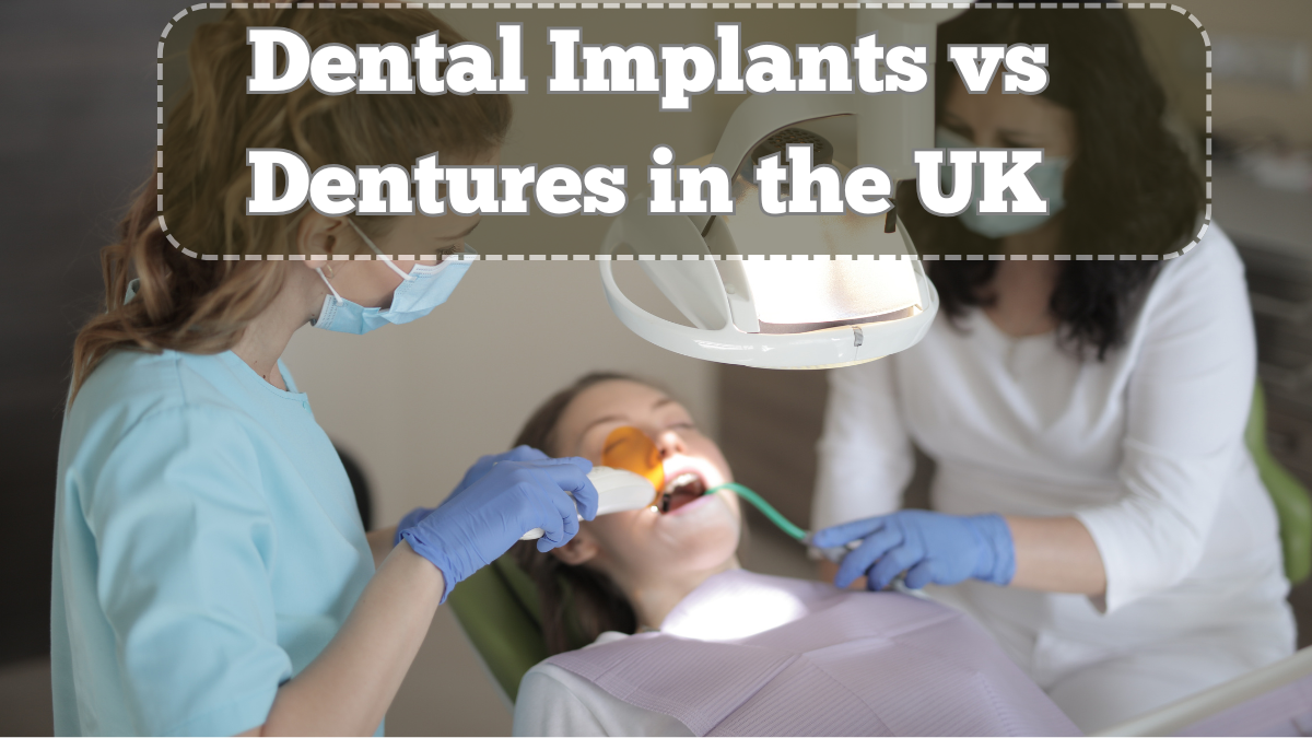 Dental Implants vs Dentures in the UK – Which Is the Better Long-Term Choice?