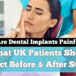 Are Dental Implants Painful? What UK Patients Should Expect Before & After Surgery