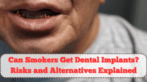 Can Smokers Get Dental Implants? Risks and Alternatives Explained