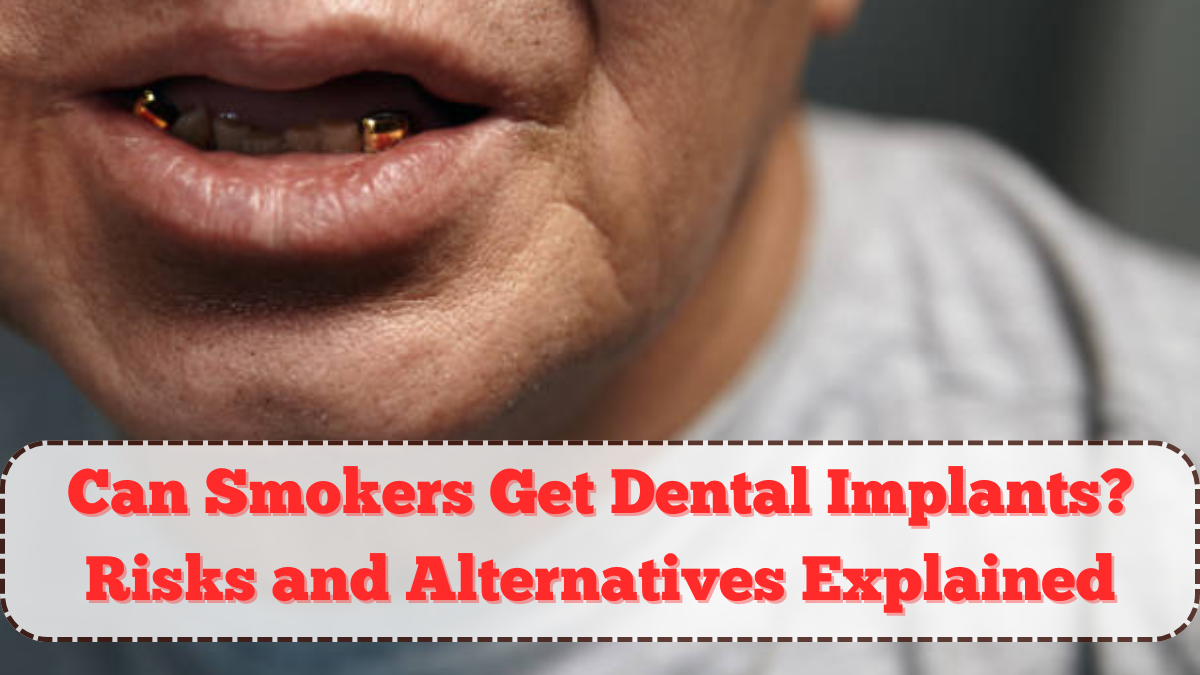 Can Smokers Get Dental Implants? Risks and Alternatives Explained