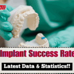 Dental Implant Success Rate 2025 UK – Latest Data & Statistics