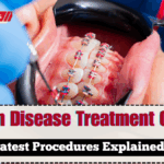 UK Gum Disease Treatment Options 2025 – Latest Procedures Explained
